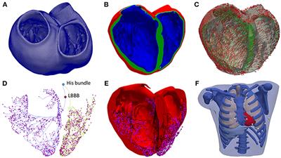 Optimization of Lead Placement in the Right Ventricle During Cardiac Resynchronization Therapy. A Simulation Study